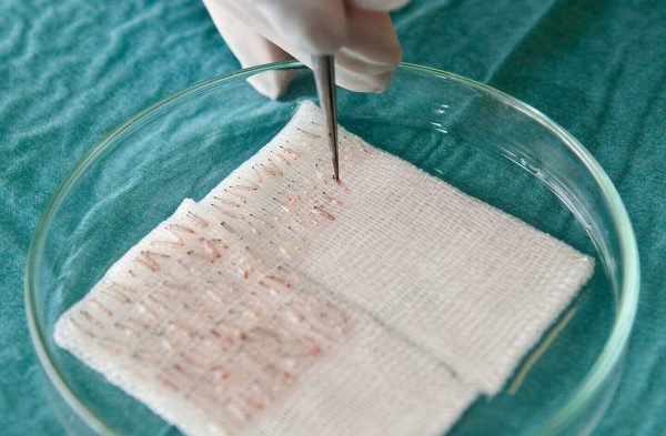 02-Hair-follicles-on-petri-dish-1440x942-1-600x393