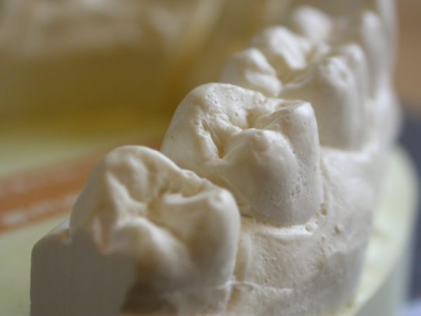 06_dental_moulds_dsc_sJpkp-600x450