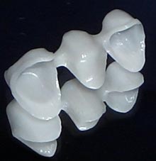 CS_Renishaw_Fig 2_zirconia bridge framework