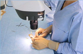 Hair-graft-dissection-280px